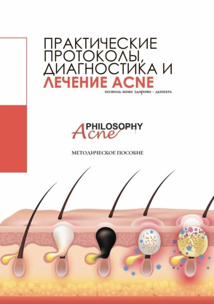 Протоколы диагностика и лечение акне ACNE PHILOSOPHY